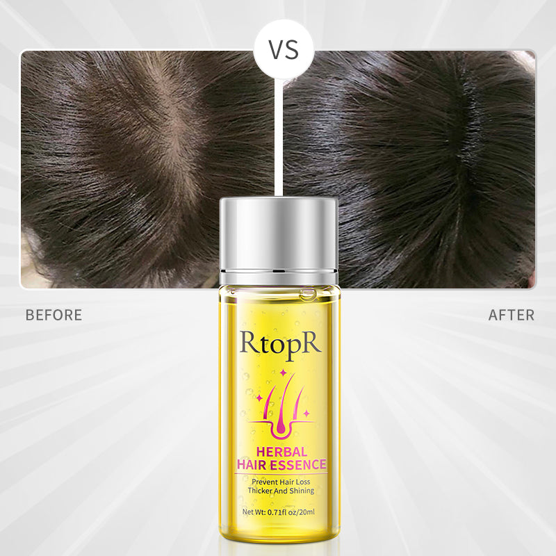 RtopR【Official Store】Herbal Hair Growth Thick Essence Prevent Hair Loss Women Hair Loss Treatment