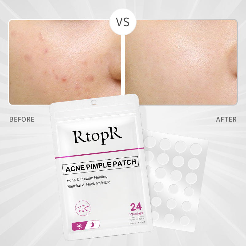 RtopR【Official Store】Acne Pimple Patch 24 Pcs