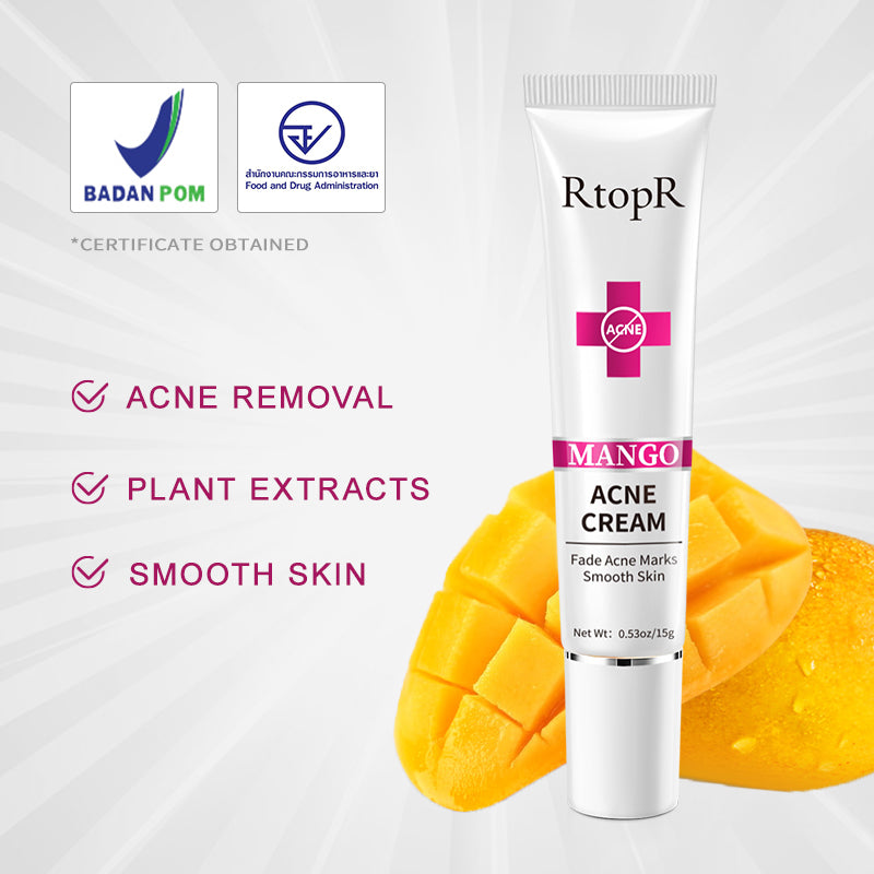RtopR【Official Store】Mango Acne Cream Acne Treatment How To Get Rid Of Acne