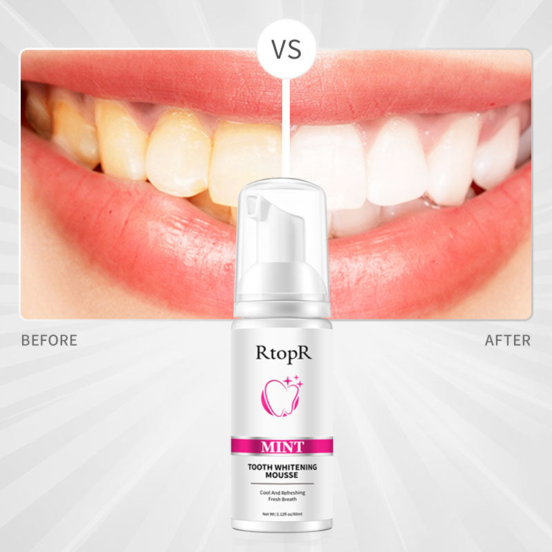 RtopR【Official Store】Mint Tooth Whitening Mousse Clean Mouth Guard Clean Mouth Products
