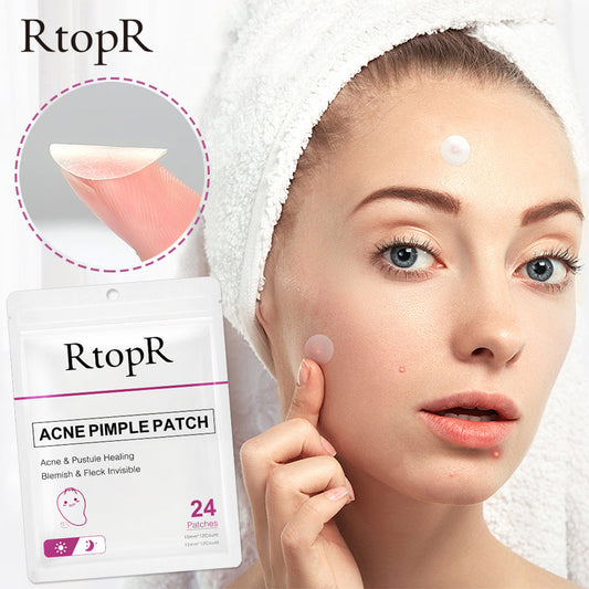 9 things you must pay attention to during acne!!