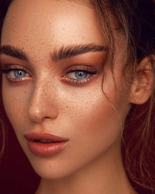 How much do you know about blackheads?