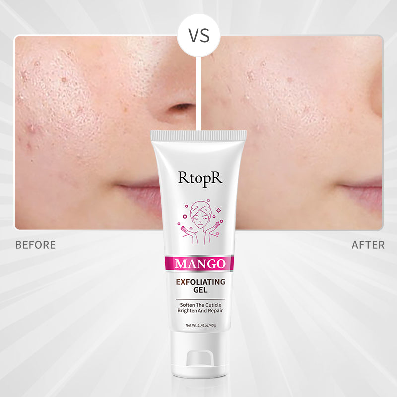 RtopR【Official Store】Mango Exfoliating Gel Face Scrub Best Exfoliator Facial cleansing